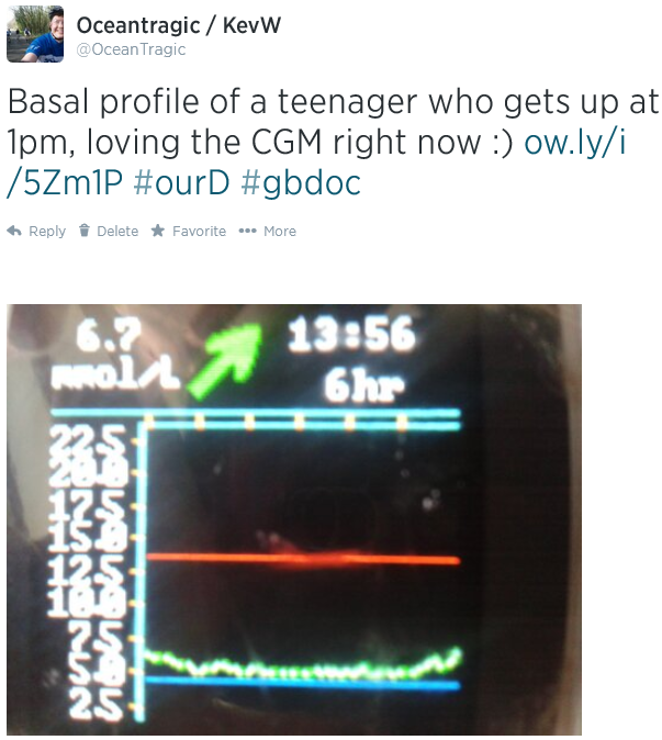 A sleeping teenager's basal profile